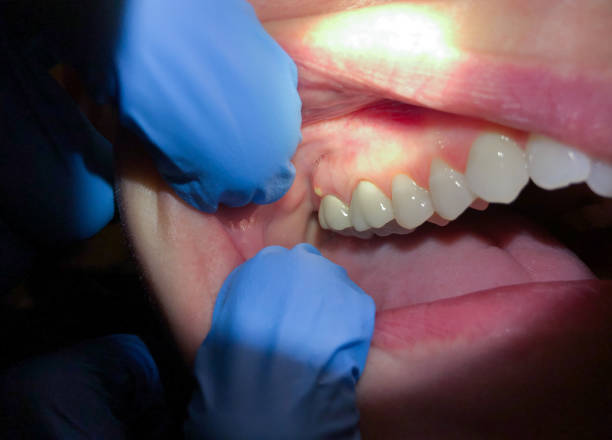 Best Emergency TMJ Treatment in Tulsa, OK